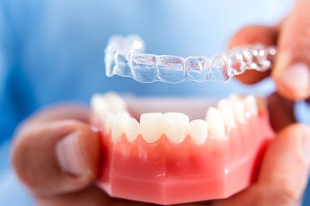 All-about-clear-aligners-and-invisible-braces