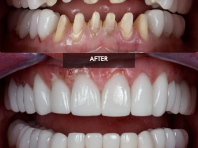 before-and-after-47