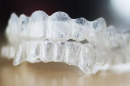 clear-aligner-pair.jpg