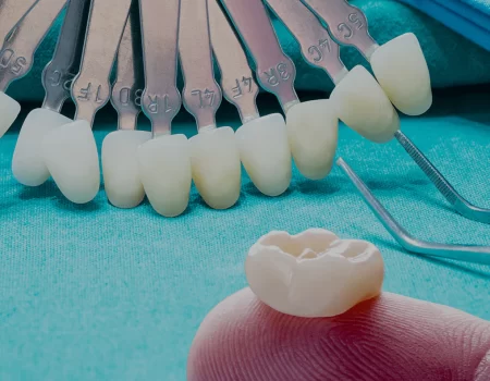 what-are-zirconia-crowns